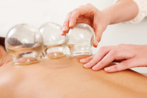 How Often Can You Do Cupping Therapy?